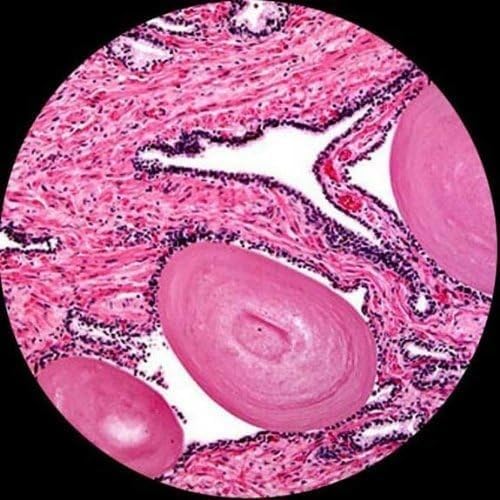 AmScope M620B Compound Monocular Microscope, WF10x and WF20x Eyepieces, 40x-2000x Magnification, Brightfield, LED Illumination, Abbe Condenser, Mechanical Stage, 110V